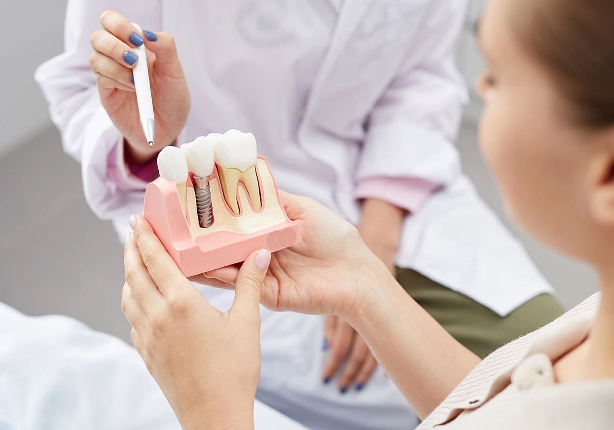 Eine Nahaufnahme einer nicht erkennbaren Ärztin zeigt, die auf ein Zahnmodell mit einem Implantat zeigt, während sie eine Patientin berät.
