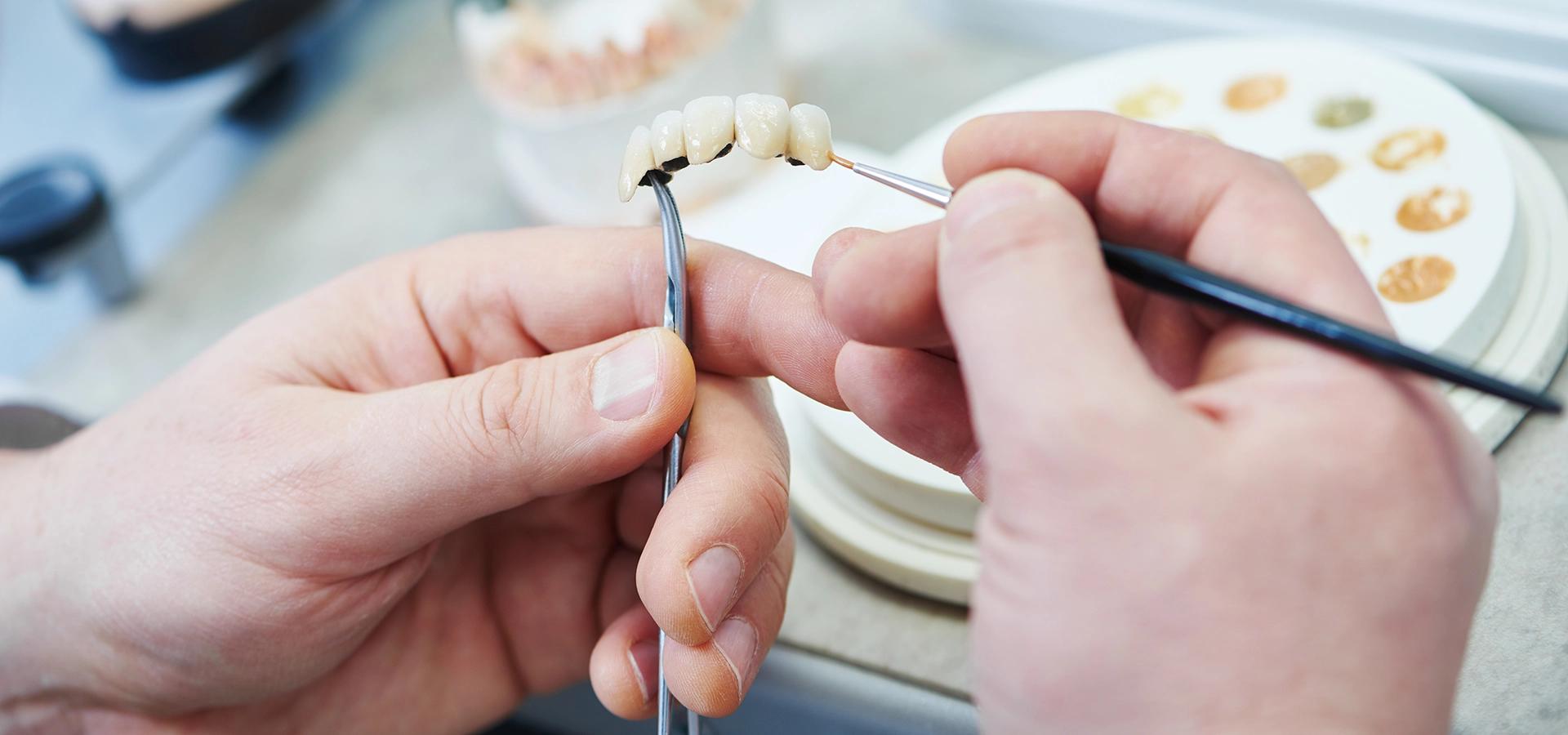Ein Bild, das Hände zeigt, die mit einer     Klammer und einem Pinsel an     Zahnprothese arbeiten.